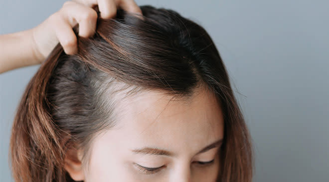 Postpartum Hair Loss: Causes, Treatments & More