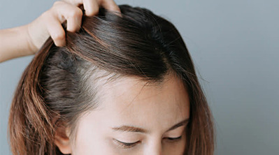 Postpartum Hair Loss: Causes, Treatments & More